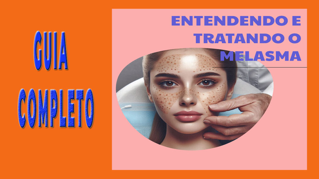 Guia Comp1eto para Esteticistas: Entendendo e Tratando o Melasma 4