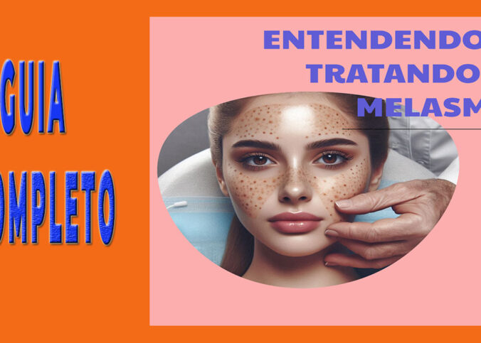 Guia Comp1eto para Esteticistas: Entendendo e Tratando o Melasma 18