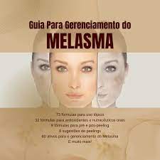 Quer oferecer o melhor cuidado para seus clientes com melasma? Aprenda tudo o que você precisa saber com nosso guia completo! Clique aqui e transforme seus conhecimentos em resultados incríveis!